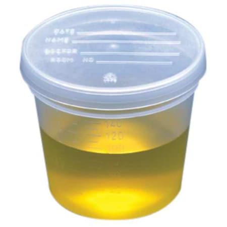Specimen Container, 5 oz., PK300